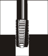 Afbeeldingen van Draadinzetstuk Standard 1,5D M 3x0,5 V-Coil